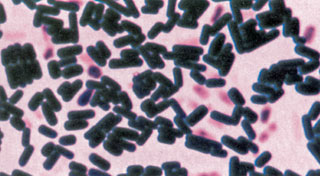 egysejtű baktériumok nő a hóna alatti bőrön
