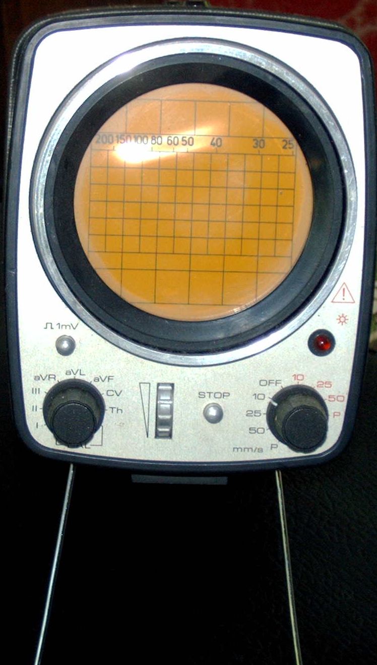 Szkópos EKG  Ára :15 000Ft