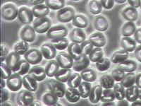 beteg ember v�rk�pe