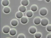 eg�szs�ges ember v�rk�pe