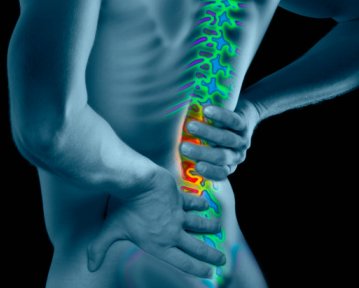 backpain1