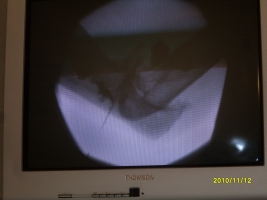 Röntgen kép