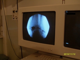 Röntgen