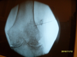 Röntgen kép