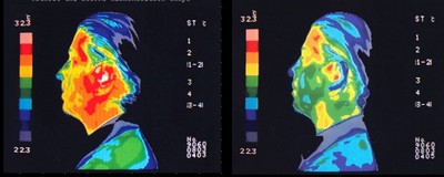 chip el�tt &eacute;s ut&aacute;n