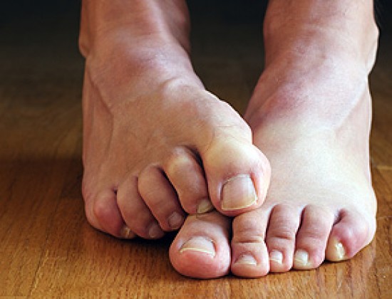 a szegecsek kezelése a penészgomboktól mi a tünetek a gomba a körmök lábánál