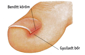 benottkorom