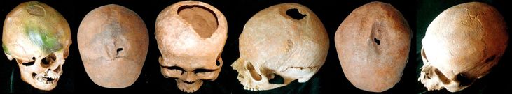 Az sk koponyi / Die Schdel der Ahnen / The skulls of the ancestors
