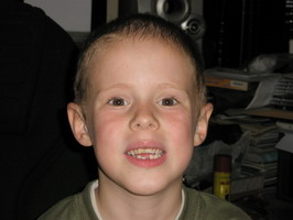 2010.06.14 - Kiesett az els� fogam